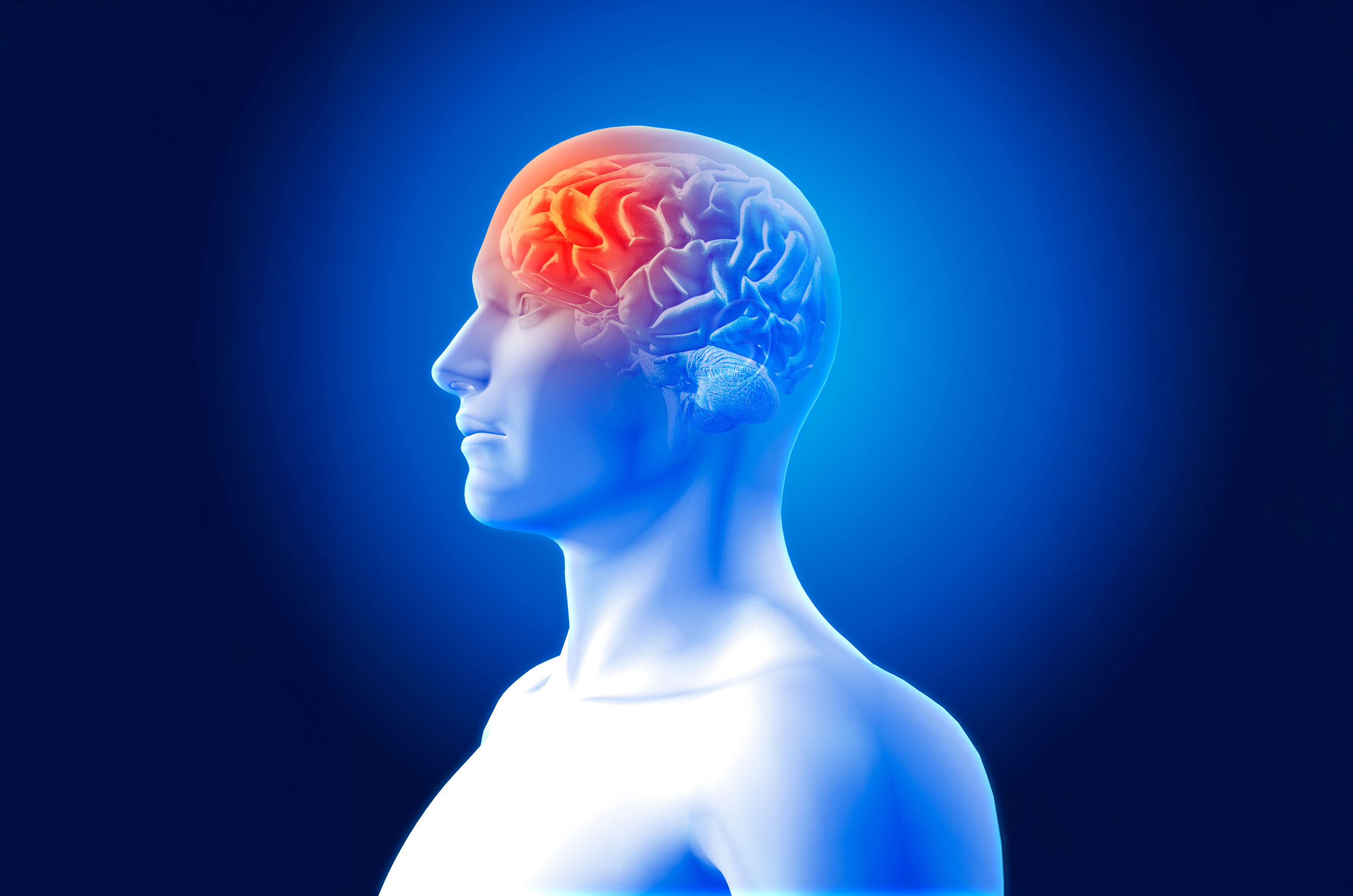 imagen 3d de un hombre y dolor en el cerebro